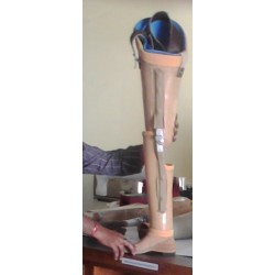A K, Above Knee Prosthesis